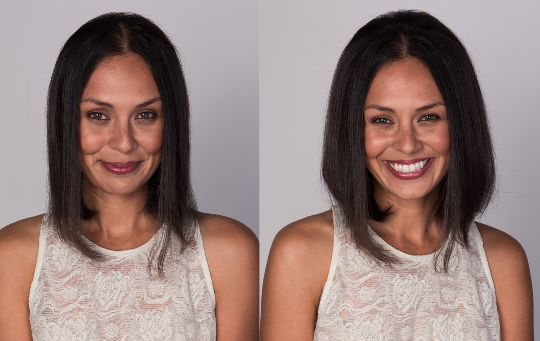 Transformations VOLOOM